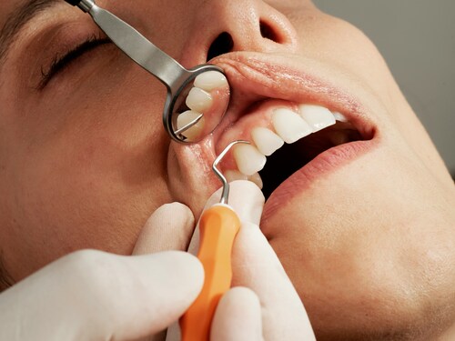 Top Benefits of Opting for Custom-Made Dentures