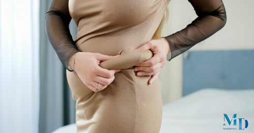 Belt Lipectomy Surgery: Restoring Body Harmony After Massive Weight Loss